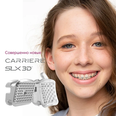 Новинка в сети стоматологий "Доктор Келлер" - брекет-система Carriere SLX 3D